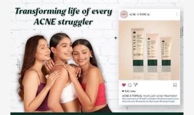 Lights, Camera, Acne-X Topical: The Glamorous Revolution in Skincare